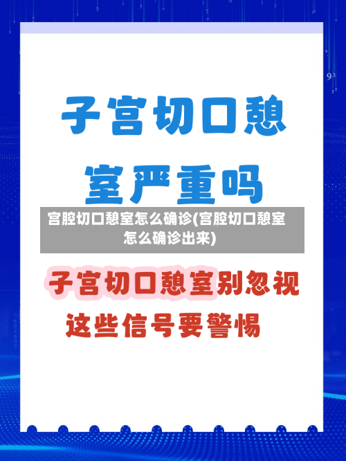 宫腔切口憩室怎么确诊(宫腔切口憩室怎么确诊出来)-第3张图片