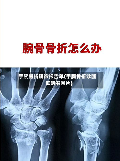 手腕骨折确诊报告单(手腕骨折诊断证明书图片)