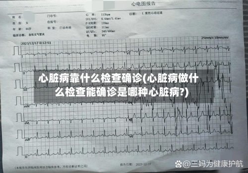 心脏病靠什么检查确诊(心脏病做什么检查能确诊是哪种心脏病?)-第2张图片