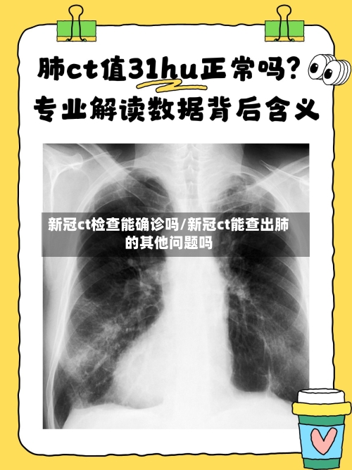 新冠ct检查能确诊吗/新冠ct能查出肺的其他问题吗