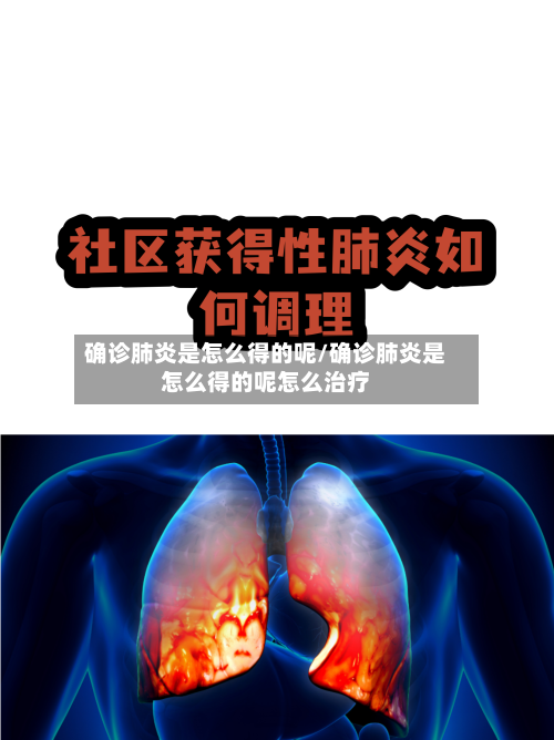 确诊肺炎是怎么得的呢/确诊肺炎是怎么得的呢怎么治疗-第2张图片